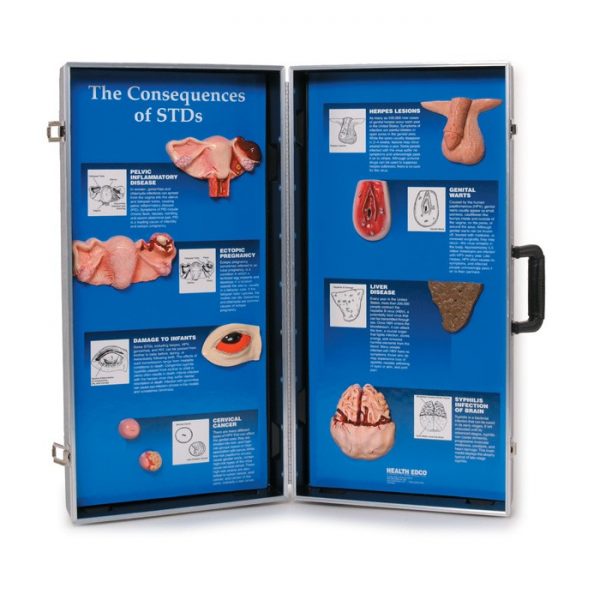 The Consequences Of Stds 3d Display Live Wire Learning