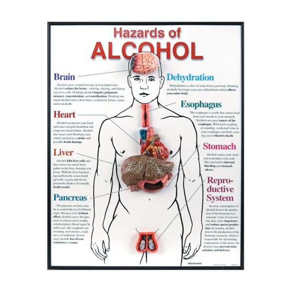  Hazards of Alcohol 3-D Framed Chart