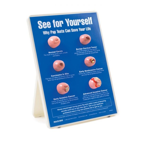 See For Yourself: Pap Tests Easel Display